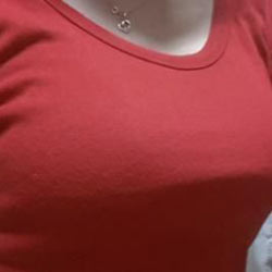 假体隆胸前后对比照,效果喜人